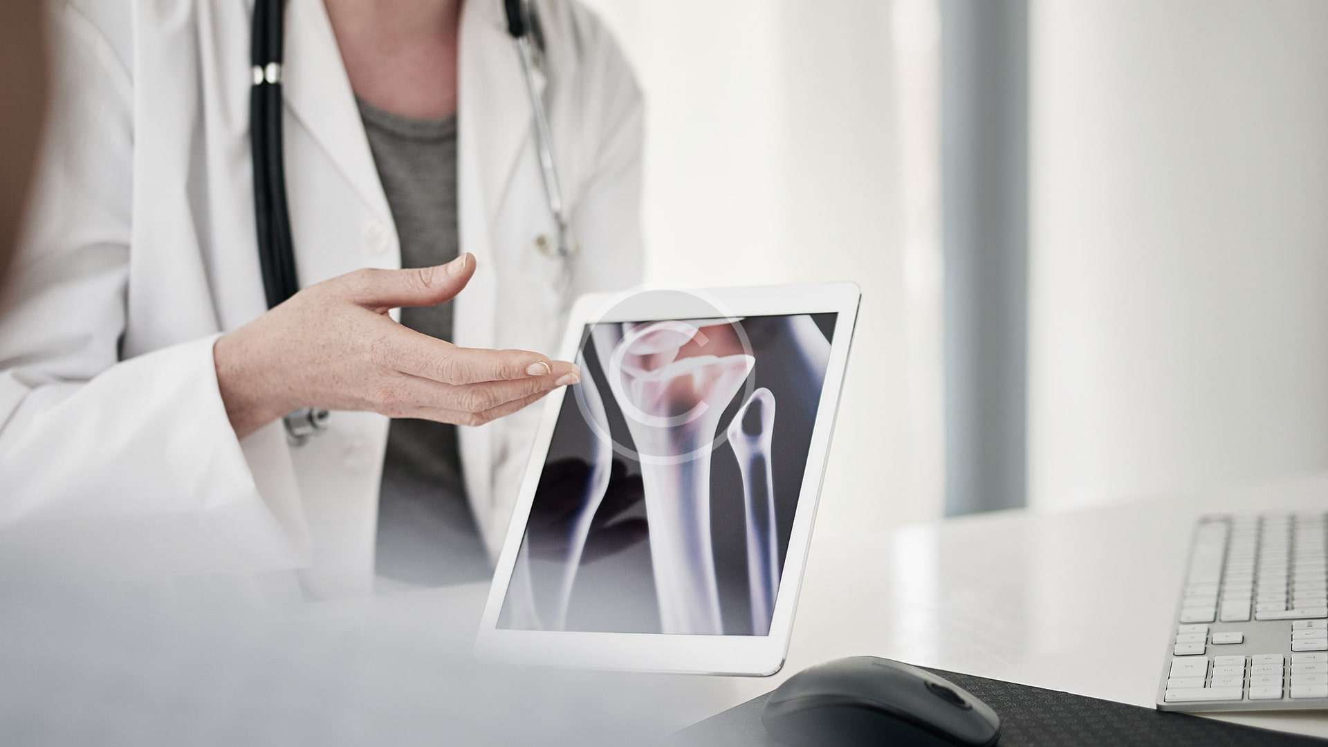 Un médico le muestra a un paciente una radiografía de una rodilla.
